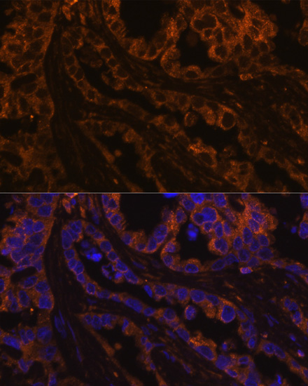 Immunofluorescence analysis of Human lung cancer cells using KRT7 Polyclonal Antibody at dilution of  1:100. Blue: DAPI for nuclear staining.