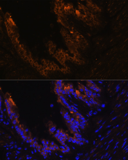 Immunofluorescence analysis of Mouse bronchus cells using KRT7 Polyclonal Antibody at dilution of  1:100. Blue: DAPI for nuclear staining.