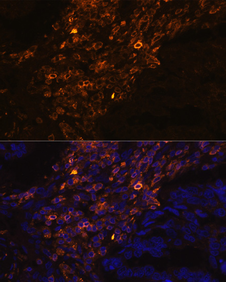 Immunofluorescence analysis of Human lung cancer cells using KRT7 Polyclonal Antibody at dilution of  1:100. Blue: DAPI for nuclear staining.