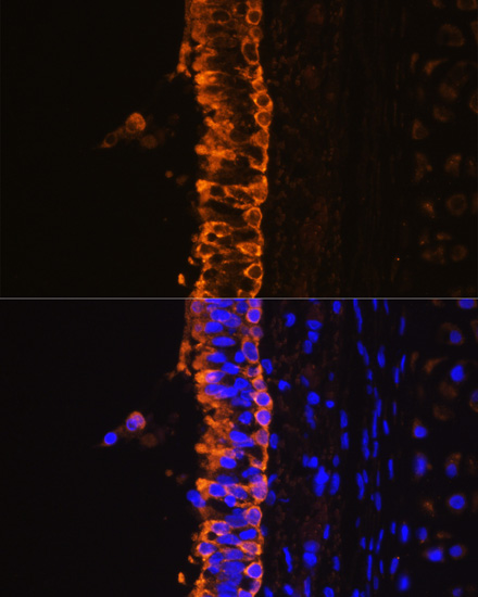 Immunofluorescence analysis of Rat bronchus cells using KRT7 Polyclonal Antibody at dilution of  1:100. Blue: DAPI for nuclear staining.