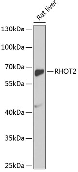 Western blot analysis of extracts of Rat liver using RHOT2 Polyclonal Antibody at dilution of 1:1000.