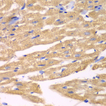 Immunohistochemistry of paraffin-embedded Mouse heart using APLP1 Polyclonal Antibody at dilution of  1:100 (40x lens).