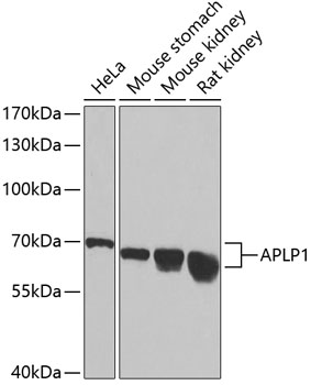 Western blot analysis of extracts of various cell lines using APLP1 Polyclonal Antibody at dilution of 1:1000.