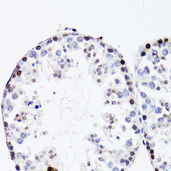 Immunohistochemistry of paraffin-embedded Mouse testis using FGF12 Polyclonal Antibody at dilution of  1:150 (40x lens).