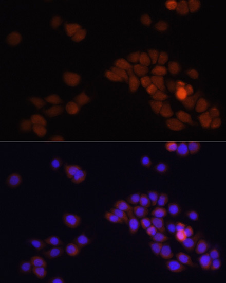 Immunofluorescence analysis of HT-29 cells using APC Polyclonal Antibody at dilution of  1:100. Blue: DAPI for nuclear staining.