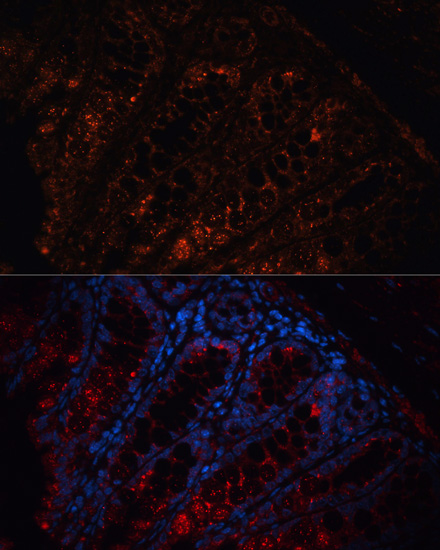 Immunofluorescence analysis of Mouse colon using APC Polyclonal Antibody at dilution of  1:100. Blue: DAPI for nuclear staining.