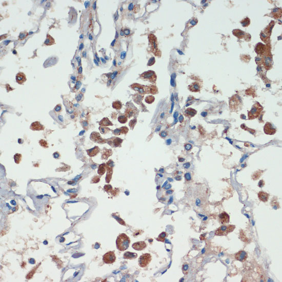 Immunohistochemistry of paraffin-embedded Human lung using APC Polyclonal Antibody at dilution of  1:200 (40x lens).