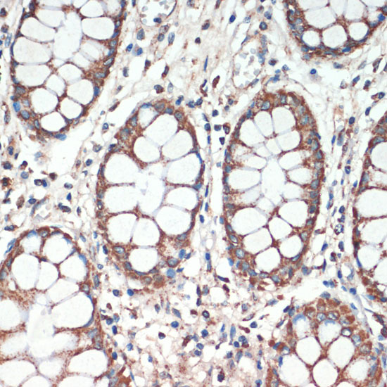 Immunohistochemistry of paraffin-embedded Human colon using APC Polyclonal Antibody at dilution of  1:200 (40x lens).
