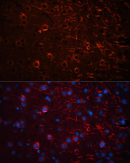 Immunofluorescence analysis of Mouse brain using Aquaporin 4 Polyclonal Antibody at dilution of  1:100 (40x lens). Blue: DAPI for nuclear staining.