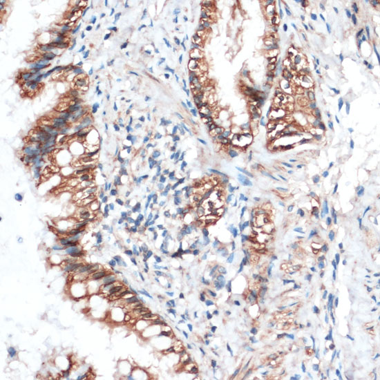 Immunohistochemistry of paraffin-embedded Rat lung using Aquaporin 4 Polyclonal Antibody at dilution of  1:100 (40x lens).