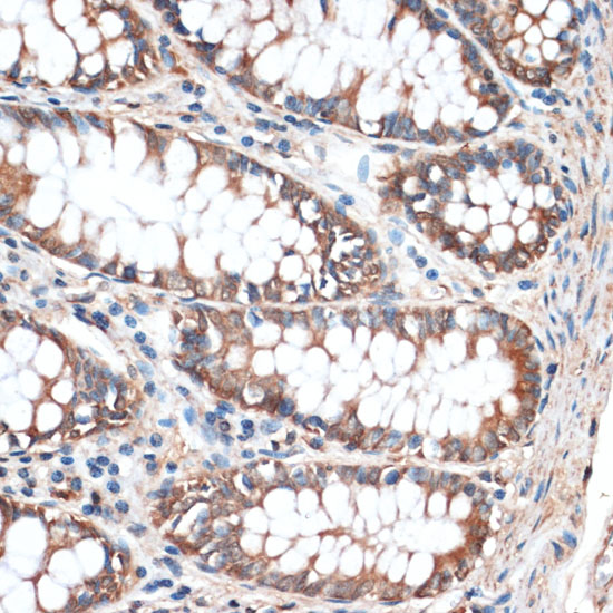 Immunohistochemistry of paraffin-embedded Human colon using Aquaporin 4 Polyclonal Antibody at dilution of  1:100 (40x lens).