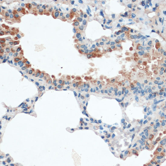 Immunohistochemistry of paraffin-embedded Mouse lung using Aquaporin 4 Polyclonal Antibody at dilution of  1:100 (40x lens).