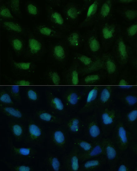 Immunofluorescence analysis of U-2 OS cells using DUT Polyclonal Antibody at dilution of  1:100 (40x lens). Blue: DAPI for nuclear staining.