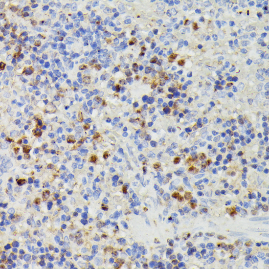 Immunohistochemistry of paraffin-embedded Rat spleen using DUT Polyclonal Antibody at dilution of  1:100 (40x lens).