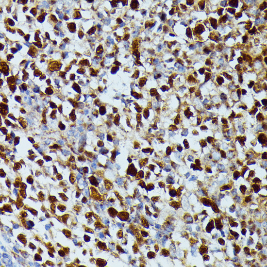 Immunohistochemistry of paraffin-embedded Human appendix using DUT Polyclonal Antibody at dilution of  1:100 (40x lens).