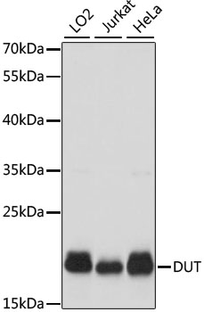 Western blot analysis of extracts of various cell lines using DUT Polyclonal Antibody at dilution of 1:1000.