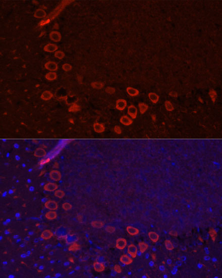 Immunofluorescence analysis of Mouse brain using SLC1A1 Polyclonal Antibody at dilution of  1:100. Blue: DAPI for nuclear staining.