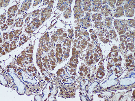Immunohistochemistry of paraffin-embedded Human stomach using SFRP1 Polyclonal Antibody at dilution of  1:50 (20x lens).