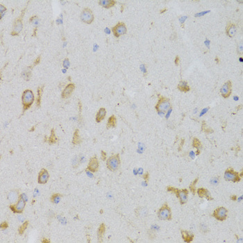 Immunohistochemistry of paraffin-embedded Mouse brain using KISS1R Polyclonal Antibody at dilution of  1:100 (40x lens).