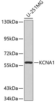 Western blot analysis of extracts of U-251MG cells using KCNA1 Polyclonal Antibody.