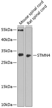 Western blot analysis of extracts of various cell lines using STMN4 Polyclonal Antibody at dilution of 1:1000.