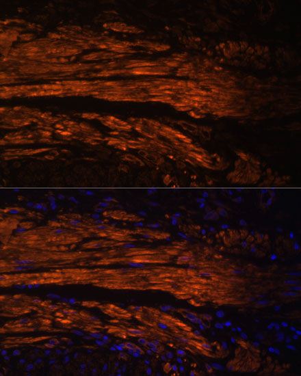 Immunofluorescence analysis of Human colon carcinoma using MYL9 Polyclonal Antibody at dilution of  1:100. Blue: DAPI for nuclear staining.