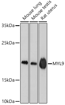 Western blot analysis of extracts of various cell lines using MYL9 Polyclonal Antibody at dilution of 1:1000.