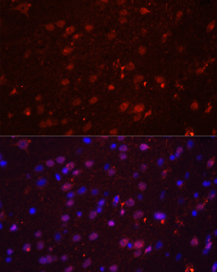 Immunofluorescence analysis of Rat brain using GRIN2B Polyclonal Antibody at dilution of  1:100. Blue: DAPI for nuclear staining.