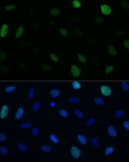 Immunofluorescence analysis of U-2 OS cells using KIFC1 Polyclonal Antibody at dilution of  1:100 (40x lens). Blue: DAPI for nuclear staining.