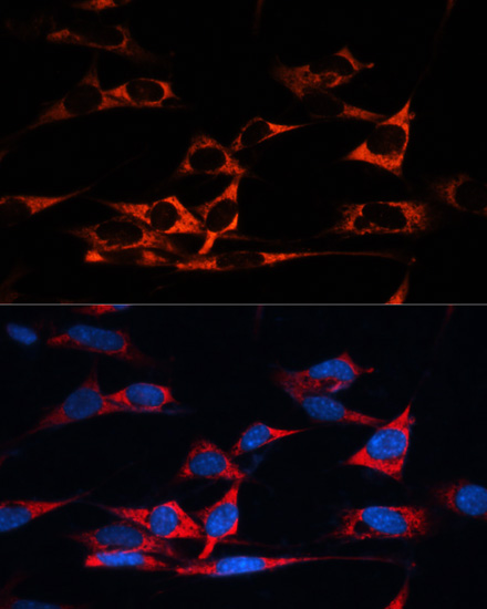 Immunofluorescence analysis of NIH/3T3 cells using MAP1B Polyclonal Antibody at dilution of  1:100. Blue: DAPI for nuclear staining.