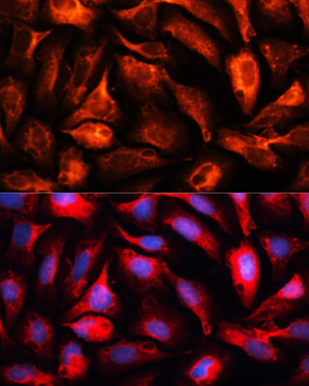 Immunofluorescence analysis of U2OS cells using MAP1B Polyclonal Antibody at dilution of  1:100. Blue: DAPI for nuclear staining.