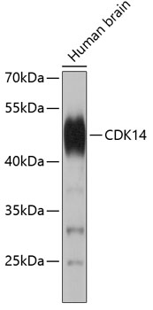 Western blot analysis of extracts of Human brain using CDK14 Polyclonal Antibody.