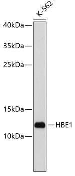 Western blot analysis of extracts of K-562 cells using HBE1 Polyclonal Antibody at dilution of 1:1000.