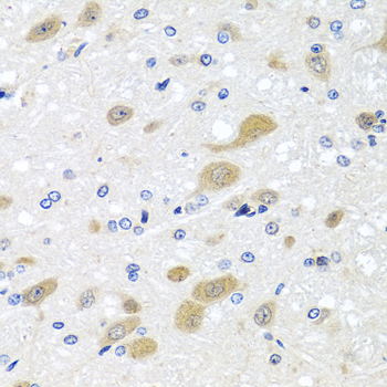 Immunohistochemistry of paraffin-embedded Rat brain using LCAT Polyclonal Antibody at dilution of  1:100 (40x lens).