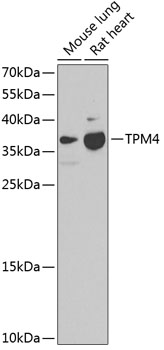 Western blot analysis of extracts of various cell lines using TPM4 Polyclonal Antibody at dilution of 1:1000.