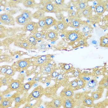 Immunohistochemistry of paraffin-embedded Mouse liver using ARHGEF5 Polyclonal Antibody at dilution of  1:100 (40x lens).