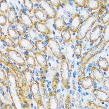 Immunohistochemistry of paraffin-embedded Mouse kidney using ARHGEF5 Polyclonal Antibody at dilution of  1:100 (40x lens).