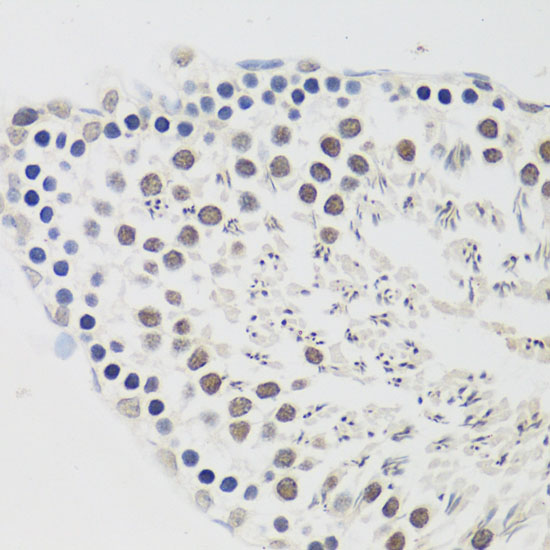 Immunohistochemistry of paraffin-embedded Rat testis using CCNE2 Polyclonal Antibody at dilution of  1:100 (40x lens).
