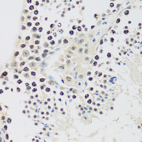 Immunohistochemistry of paraffin-embedded Mouse testis using CCNE2 Polyclonal Antibody at dilution of  1:100 (40x lens).