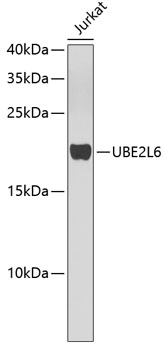 Western blot analysis of extracts of Jurkat cells using UBE2L6 Polyclonal Antibody.