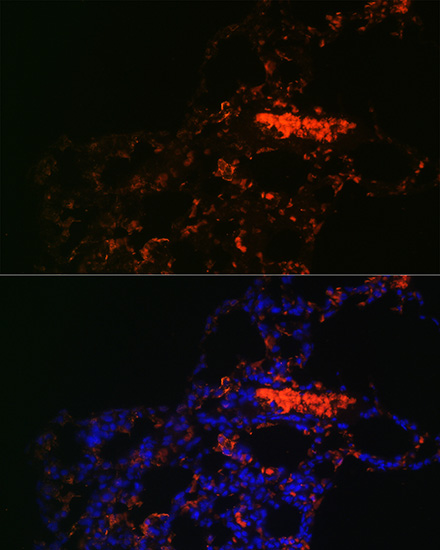Immunofluorescence analysis of Rat lung using ABCG1 Polyclonal Antibody at dilution of  1:100. Blue: DAPI for nuclear staining.