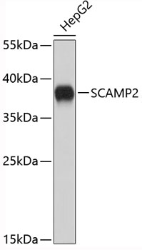 Western blot analysis of extracts of HepG2 cells using SCAMP2 Polyclonal Antibody.