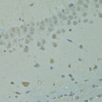 Immunohistochemistry of paraffin-embedded Rat brain using IVNS1ABP Polyclonal Antibody at dilution of  1:100 (40x lens).