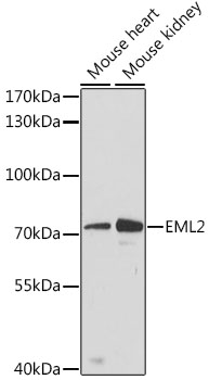 Western blot analysis of extracts of various cell lines using EML2 Polyclonal Antibody at dilution of 1:3000.