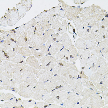 Immunohistochemistry of paraffin-embedded Mouse heart using GTF2H2 Polyclonal Antibody at dilution of  1:100 (40x lens).