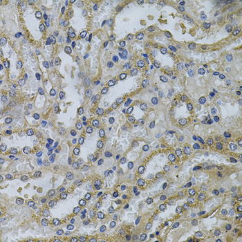 Immunohistochemistry of paraffin-embedded Mouse kidney using SERPINE2 Polyclonal Antibody at dilution of  1:100 (40x lens).