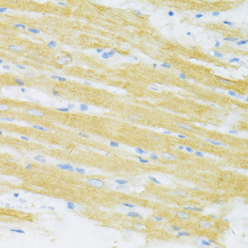 Immunohistochemistry of paraffin-embedded Rat heart using TYROBP Polyclonal Antibody at dilution of  1:100 (40x lens).