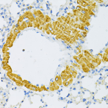 Immunohistochemistry of paraffin-embedded Mouse lung using TYROBP Polyclonal Antibody at dilution of  1:100 (40x lens).