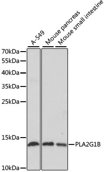 Western blot analysis of extracts of various cell lines using PLA2G1B Polyclonal Antibody at dilution of 1:1000.