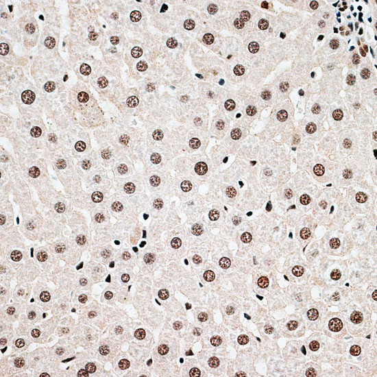 Immunohistochemistry of paraffin-embedded Rat liver using CBX6 Polyclonal Antibody at dilution of  1:100 (40x lens).